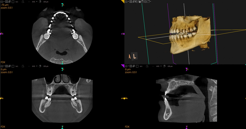 Radiografía panorámica dental de alta resolución