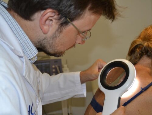 cáncer de piel hospital hc marbella