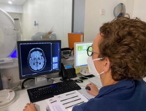 accidente isquémico transitorio hc marbella