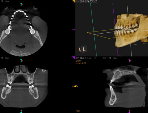 Radiografía panorámica dental de alta resolución